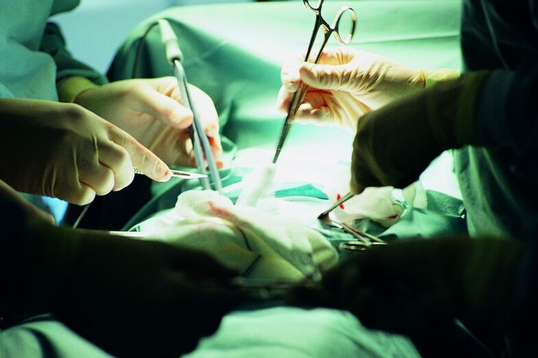 chirurgische toename van de penisdikte